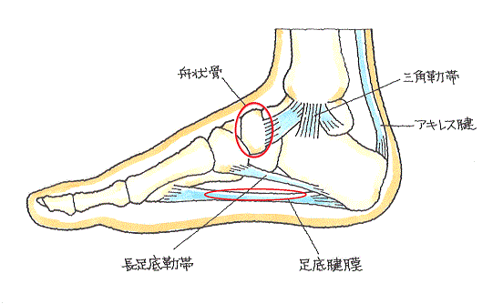 足底腱膜