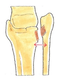 脛腓靭帯